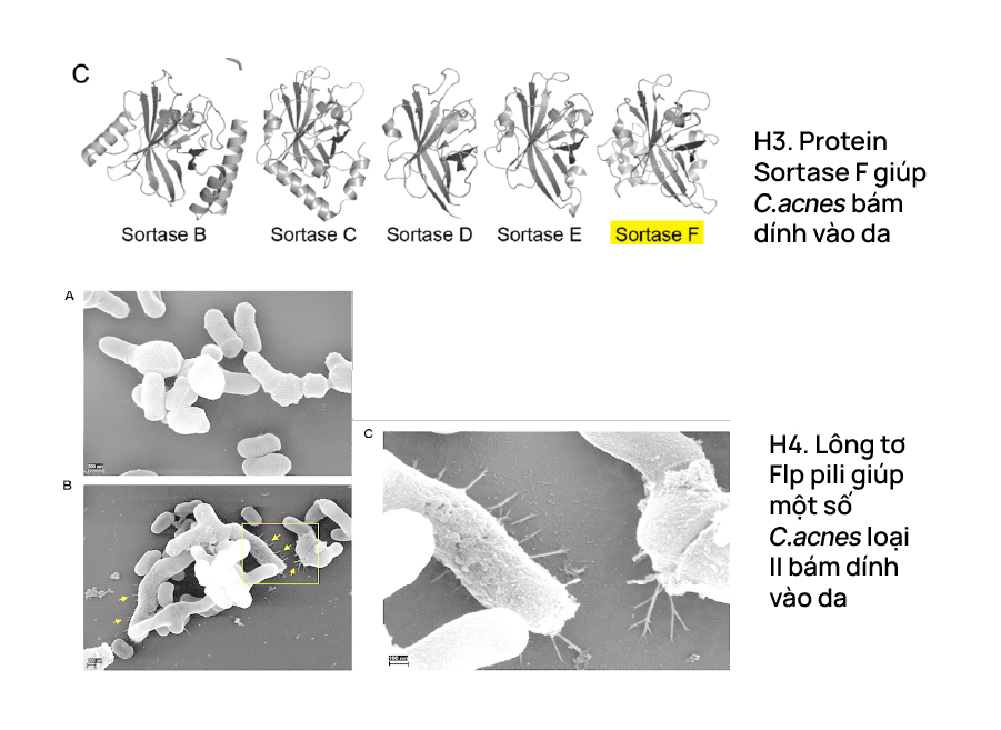 Protein Sortase F giúp C. acnes bám dính vào da
Lông tơ Flp pili giúp một số C. acnes loại II bám dính vào da