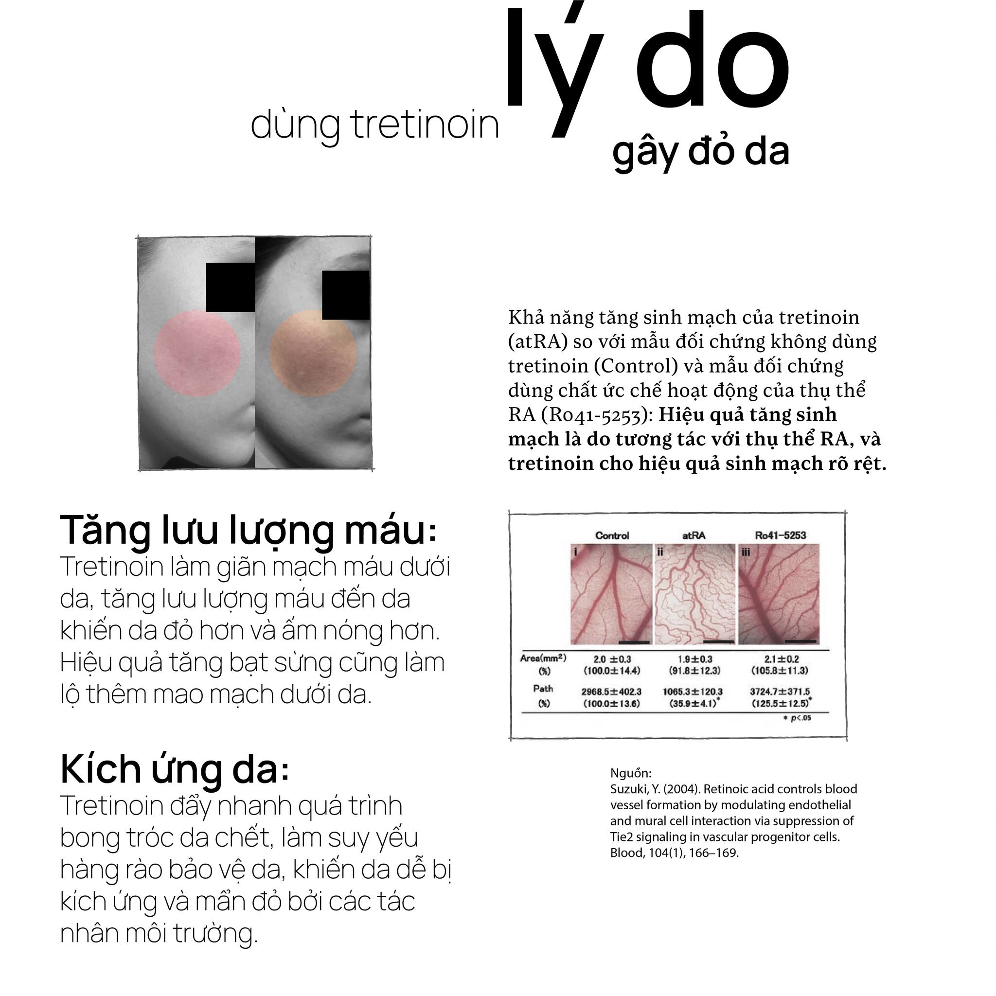 Lý do dùng tretinoin gây đỏ da 