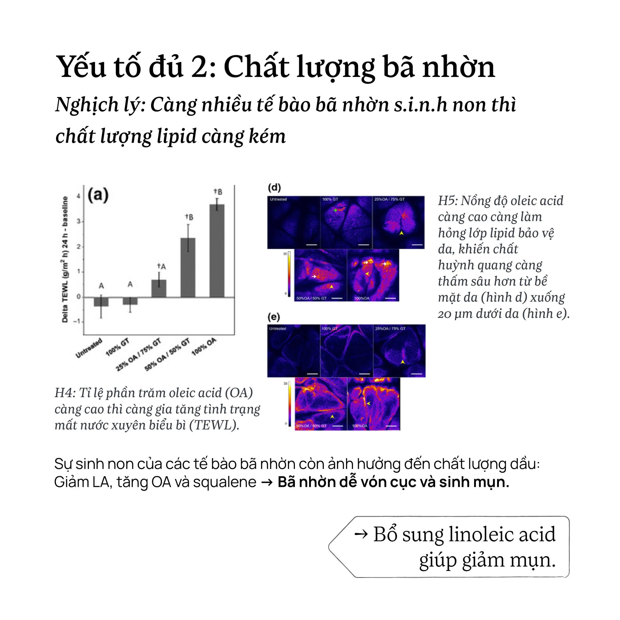 Yếu tố đủ 2: Chất lượng bã nhờn Nghịch lý: Càng nhiều tế bào bã nhờn sinh non thì chất lượng lipid càng kém