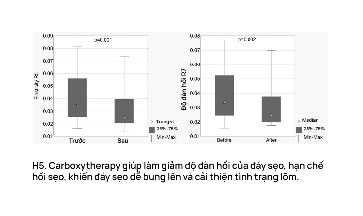 Carboxytherapy giúp làm giảm độ đàn hồi của đáy sẹo, hạn chế hồi sẹo, khiến đáy sẹo dễ bung lên và cải thiện tình trạng lõm.